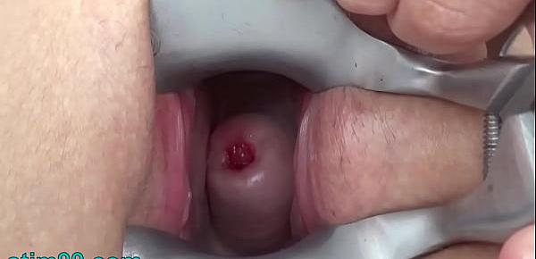  Cervix Fucking Porn Video with Drilldo Penetration